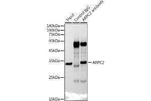 Immunoprecipitation analysis of 300 μg extracts of HepG2 cells using 3 μg  antibody (ABIN7265385). (ARPC2 抗体)