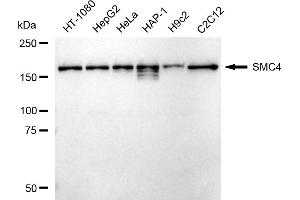 Western blotting analysis using SMC4 antibody (ABIN7800449). (Recombinant SMC4 抗体)