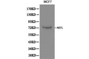 Western Blotting (WB) image for anti-Neurofilament, Light Polypeptide (NEFL) antibody (ABIN1873871) (NEFL 抗体)