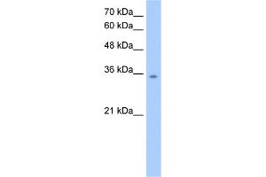 WB Suggested Anti-MDH2 Antibody Titration:  2.