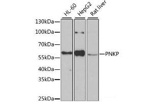 Western blot analysis of extracts of various cell lines using PNKP Polyclonal Antibody at dilution of 1:1000. (PNKP 抗体)