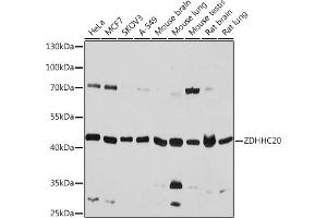 Western blot analysis of extracts of various cell lines, using ZDHHC20 antibody (ABIN7271551) at 1:1000 dilution. (ZDHHC20 抗体)