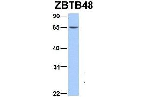 Western Blotting (WB) image for anti-Ets Variant 5 (ETV5) (N-Term) antibody (ABIN2780594)