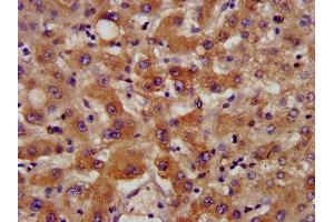IHC image of ABIN7170786 diluted at 1:400 and staining in paraffin-embedded human liver tissue performed on a Leica BondTM system. (NSDHL 抗体  (AA 154-211))