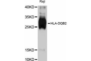 Western blot analysis of extracts of Raji cells, using HLA-DQB2 antibody (ABIN5997902) at 1:3000 dilution. (HLA-DQB2 抗体)