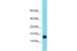 Host: Rabbit Target Name: FUOM Sample Type: Fetal Heart lysates Antibody Dilution: 1. (FUOM 抗体  (Middle Region))