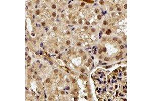 Immunohistochemistry (IHC) image for anti-Golgi-Associated, gamma Adaptin Ear Containing, ARF Binding Protein 2 (GGA2) antibody (ABIN7305940)