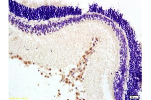 Formalin-fixed and paraffin embedded rat retina labeled with Anti-MTNR1B Polyclonal Antibody, Unconjugated (ABIN730318) at 1:200 followed by conjugation to the secondary antibody and DAB staining. (Melatonin Receptor 1B 抗体  (AA 201-300))