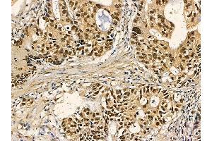 anti-Nucleoporin 188kDa (NUP188) antibody