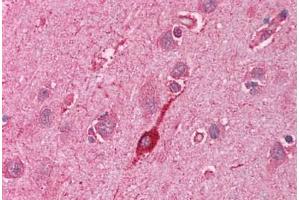 Human Brain, Cortex (formalin-fixed, paraffin-embedded) stained with HMOX2 antibody ABIN214113 at 5 ug/ml followed by biotinylated goat anti-rabbit IgG secondary antibody ABIN481713, alkaline phosphatase-streptavidin and chromogen. (HMOX2 抗体  (N-Term))