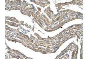 Asporin antibody was used for immunohistochemistry at a concentration of 4-8 ug/ml to stain Skeletal muscle cells (arrows) in Human Muscle. (Asporin 抗体  (Middle Region))