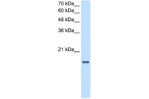 WB Suggested Antibody Titration:  2.
