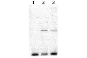 Lanes 1-3 contained Clock polyclonal antibody  immunoprecipitated DNA (15, 10 and 5 uL of antisera added respectively to the 900 uL of sonicated chromatin sample in the ChIP assay).