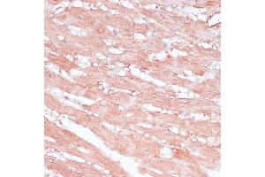 Immunohistochemistry of paraffin-embedded rat heart using RPL30 antibody (ABIN6130903, ABIN6147135, ABIN6147136 and ABIN6217777) at dilution of 1:100 (40x lens). (RPL30 抗体  (AA 1-115))