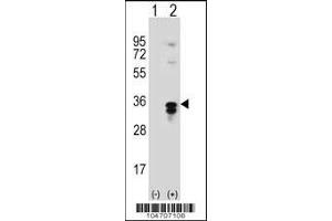 Western blot analysis of PPT1 using rabbit polyclonal PPT1 Antibody (A284) using 293 cell lysates (2 ug/lane) either nontransfected (Lane 1) or transiently transfected (Lane 2) with the PPT1 gene. (PPT1 抗体  (C-Term))