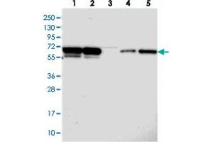 Western blot analysis of Lane 1: RT-4, Lane 2: U-251 MG, Lane 3: Human Plasma, Lane 4: Liver, Lane 5: Tonsil with PSPC1 polyclonal antibody  at 1:250-1:500 dilution. (PSPC1 抗体)
