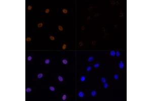 Immunofluorescence analysis of C6 cells using Acetyl-Histone H3-K23 (ABIN7267669) at dilution of 1:100.