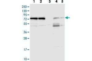 Western blot analysis of Lane 1: RT-4, Lane 2: U-251 MG, Lane 3: Human Plasma, Lane 4: Liver, Lane 5: Tonsil with KARS polyclonal antibody  at 1:250-1:500 dilution. (KARS 抗体)