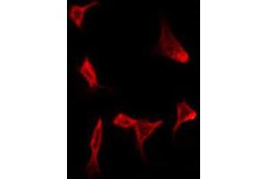 ABIN6272275 staining HeLa by IF/ICC. (CMTM4 抗体  (N-Term))