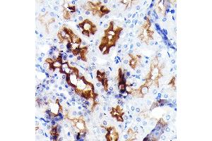 Immunohistochemistry of paraffin-embedded rat kidney using P Glycoprotein Rabbit mAb (ABIN7265732) at dilution of 1:100 (40x lens). (ABCB1 抗体)