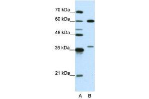 WB Suggested Anti-HNRPL  Antibody Titration: 0. (HNRNPL 抗体  (N-Term))