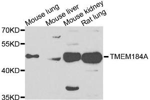 Western blot analysis of extracts of various cells, using TMEM184A antibody. (TMEM184A 抗体)