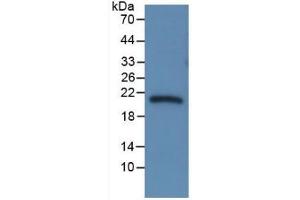 Western Blotting (WB) image for serpin Peptidase Inhibitor, Clade A (Alpha-1 Antiproteinase, Antitrypsin), Member 6 (SERPINA6) ELISA Kit (ABIN6730988)