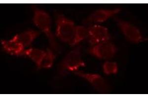 ABIN6274742 staining COS7 by IF/ICC. (MRPL44 抗体)