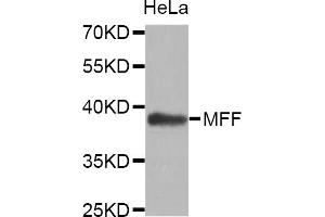 Western blot analysis of extracts of HeLa cells, using MFF antibody (ABIN5972807). (MFF 抗体)