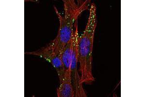 Immunofluorescence analysis of NIH/3T3 cells using KLHL1 mouse mAb (green). (KLHL1 抗体)