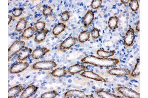 Immunohistochemistry (IHC) image for anti-Cytochrome P450, Family 1, Subfamily B, Polypeptide 1 (CYP1B1) (AA 255-480) antibody (ABIN3042785)