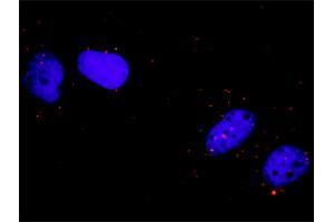 Proximity Ligation Analysis of protein-protein interactions between FLT1 and CRK. (Crk 抗体  (AA 1-204))