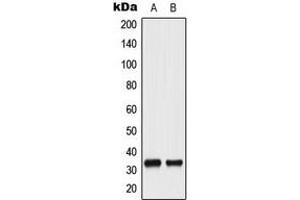 Western blot analysis of CDC2 (pY15) expression in HeLa UV-treated (A), A431 (B) whole cell lysates.