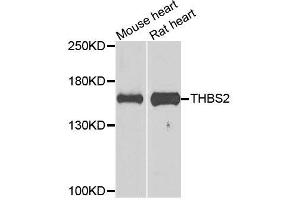 Western blot analysis of extracts of various cell lines, using THBS2 antibody (ABIN5996361) at 1/1000 dilution. (Thrombospondin 2 抗体)