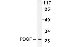 Image no. 1 for anti-Platelet Derived Growth Factor Subunit B (PDGFB) antibody (ABIN271781) (PDGFB 抗体)