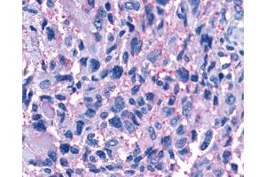 Immunohistochemistry (IHC) image for anti-Purinergic Receptor P2Y, G-Protein Coupled, 11 (P2RY11) (Extracellular Domain) antibody (ABIN1049205)