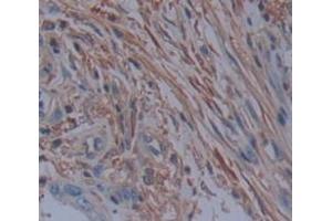 IHC-P analysis of Human Tissue, with DAB staining. (PDE4D 抗体  (AA 581-809))