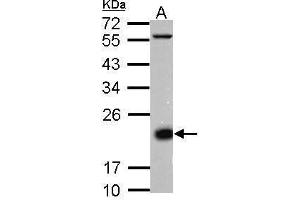 WB Image Sample (30 ug of whole cell lysate) A: Jurkat membrane 12% SDS PAGE antibody diluted at 1:10000 (CD3D 抗体  (Center))