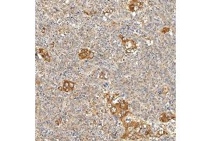 IHC analysis of SNPH using anti-SNPH antibody (ABIN7601724). (Syntaphilin 抗体  (AA 43-482))