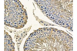 PKM2 Mouse Monoclonal Antibody at 1/100 staining rat testis tissue by IHC-P.