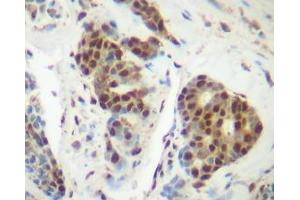 Image no. 1 for anti-Tumor Necrosis Factor alpha (TNF alpha) antibody (ABIN465605) (TNF alpha 抗体)