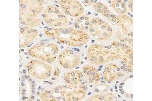 Immunohistochemistry analysis of paraffin-embedded human kidney using,MAP3K12 (ABIN7074679) at dilution of 1: 400 (MAP3K12 抗体)