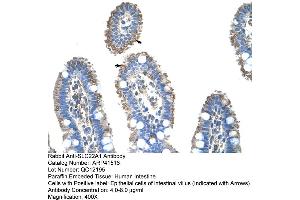 Immunohistochemistry (IHC) image for anti-Solute Carrier Family 22 (Organic Cation Transporter), Member 1 (SLC22A1) (N-Term) antibody (ABIN2776861)