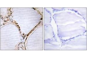 Immunohistochemistry (IHC) image for anti-BMX Non-Receptor Tyrosine Kinase (BMX) (AA 532-581) antibody (ABIN2888766) (BMX 抗体  (AA 532-581))