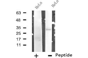 Western blot analysis of extracts from HeLa cells, using RNF144B antibody. (RNF144B 抗体  (Internal Region))