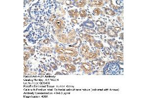 Rabbit Anti-AUH Antibody  Paraffin Embedded Tissue: Human Kidney Cellular Data: Epithelial cells of renal tubule Antibody Concentration: 4. (AUH 抗体  (C-Term))