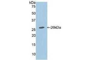 Detection of Recombinant APC, Mouse using Polyclonal Antibody to Adenomatosis Polyposis Coli Protein (APC) (APC 抗体  (AA 2636-2845))