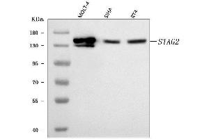 Western blot analysis of SA2/STAG2 using anti-SA2/STAG2 antibody (ABIN7602420).