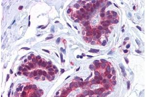 Human Breast: Formalin-Fixed, Paraffin-Embedded (FFPE) (CCDC106 抗体  (C-Term))