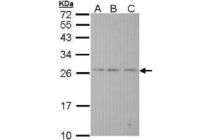 WB Image Sample (30 ug of whole cell lysate) A: Hela B: Hep G2 , C: Molt-4 , 12% SDS PAGE antibody diluted at 1:1000 (BAK1 抗体  (N-Term))